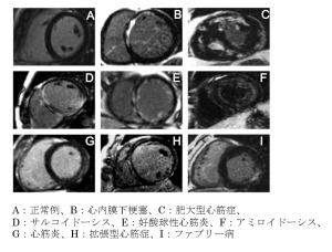 図2　各疾患における遅延造影像（LGE）の代表例　 文献[3]　より改変引用
